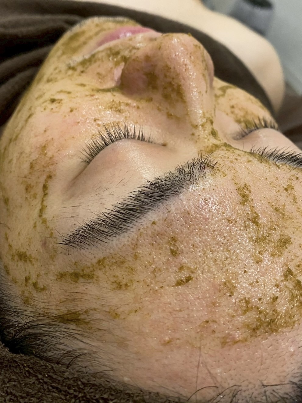 ハーブピーリング